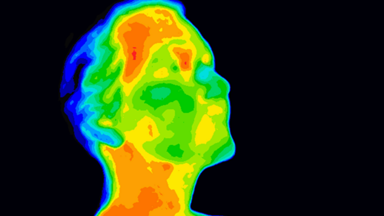 infrared imaging